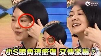 家暴爆料新闻,揭开家暴事件的残酷真相