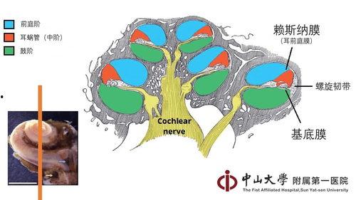 耳蜗在线观看,揭秘听觉世界的奥秘之旅  第2张